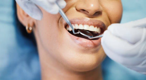 Best Emergency Dentist for Lost Fillings or Crowns in Bellevue, OH